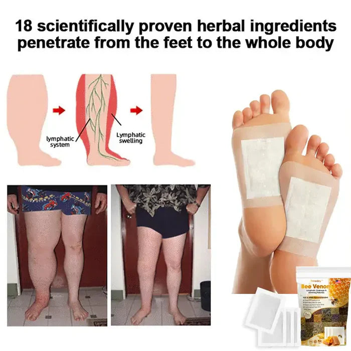 Bee Venom Detox Foot Patches 🔥🔥🔥