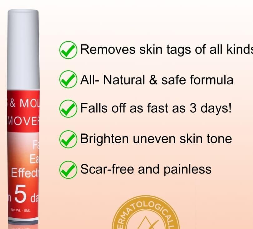 LOVILDS™ Tags & Moles Remover (Buy 1 Get 1 Free🔥🔥)